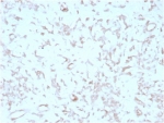 IHC staining of FFPE human liver tissue with Kindlin 2 antibody (clone 3A3). HIER: boil tissue sections in pH 9 10mM Tris with 1mM EDTA for 20 min and allow to cool before testing.