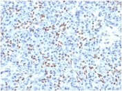 IHC staining of FFPE human pancreatic tissue with SOX9 antibody (clone PCRP-SOX9-1A2). HIER: boil tissue sections in pH 9 10mM Tris with 1mM EDTA for 20 min and allow to cool before testing.
