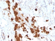 IHC testing of FFPE human pituitary gland with anti-ACTH antibody (clone SPM333).