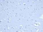 Negative control: IHC staining of FFPE human brain tissue with recombinant CD8A antibody (clone rCD8/6590) at 2ug/ml in PBS for 30min RT. HIER: boil tissue sections in pH 9 10mM Tris with 1mM EDTA for 20 min and allow to cool before testing.