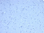 Negative control: IHC staining of FFPE human brain tissue using TOM1L1 antibody (clone TOM1L1/4690) at 2ug/ml in PBS for 30min RT. HIER: boil tissue sections in pH 9 10mM Tris with 1mM EDTA for 20 min and allow to cool before testing.