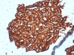 IHC staining of FFPE human pancreatic tissue with recombinant Synaptophysin antibody (clone SYP/4389R). HIER: boil tissue sections in pH 9 10mM Tris with 1mM EDTA for 20 min and allow to cool before testing.