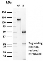 SDS-PAGE analysis of purified, BSA-free recombinant CDH1 antibody (CDH1/7034R) as confirmation of integrity and purity.