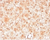 IHC staining of FFPE human brain tissue with PRKCI antibody (clone PRKCI/4911). HIER: boil tissue sections in pH 9 10mM Tris with 1mM EDTA for 20 min and allow to cool before testing.