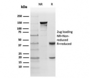 SDS-PAGE analysis of purified, BSA-free PRKCI antibody (clone PRKCI/4911) as confirmation of integrity and purity.