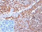 IHC staining of FFPE human tonsil tissue with Gamma Parvin antibody (clone 8C5.2) at 2ug/ml in PBS. Negative control inset: PBS instead of primary antibody to control for secondary binding. HIER: boil tissue sections in pH 9 10mM Tris with 1mM EDTA for 20 min and allow to cool before testing.