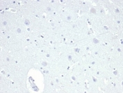 Negative control: IHC staining of FFPE human brain tissue using recombinant TROP2 antibody (clone TACSTD2/6396R) at 2ug/ml in PBS for 30min RT. HIER: boil tissue sections in pH 9 10mM Tris with 1mM EDTA for 20 min and allow to cool before testing.