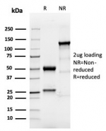 SDS-PAGE analysis of purified, BSA-free TACSTD2 antibody (clone TACSTD2/6394R) as confirmation of integrity and purity.