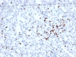 IHC staining of FFPE human spleen tissue with recombinant GZMB antibody (clone rGZMB/6740). HIER: boil tissue sections in pH 9 10mM Tris with 1mM EDTA for 20 min and allow to cool before testing.