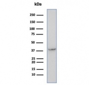 Western blot testing of human SW732 cell lysate using SERPINB5 antibody (clone SERPINB5/4972). Predicted molecular weight: 42~45 kDa.