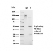 SDS-PAGE analysis of purified, BSA-free CHRAC17 antibody (clone PCRP-POLE3-3D3) as confirmation of integrity and purity.