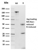 SDS-PAGE analysis of purified, BSA-free Lactoferrin antibody (clone LTF/4079) as confirmation of integrity and purity.