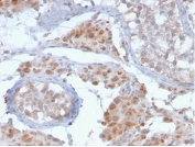 IHC staining of FFPE human testis tissue with GCSAM antibody (clone HGAL/2373). HIER: boil tissue sections in pH 9 10mM Tris with 1mM EDTA for 20 min and allow to cool before testing.
