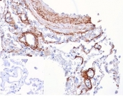 IHC staining of FFPE human lung tissue with Fibroblast Growth Factor 21 antibody (clone FGF21/4343). Negative control inset: PBS instead of primary antibody to control for secondary binding. HIER: boil tissue sections in pH 9 10mM Tris with 1mM EDTA for 20 min and allow to cool before testing.