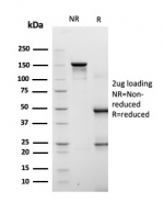 SDS-PAGE analysis of purified, BSA-free Fatty Acid Binding Protein 4 antibody (clone FABP4/4422) as confirmation of integrity and purity.