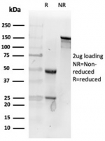 SDS-PAGE analysis of purified, BSA-free Fibroblast Activation Protein Alpha antibody (clone FAP/4853) as confirmation of integrity and purity.