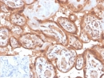 IHC staining of FFPE human placental tissue with Fibroblast Activation Protein Alpha antibody (clone FAP/4853). Negative control inset: PBS instead of primary antibody to control for secondary binding. HIER: boil tissue sections in pH 9 10mM Tris with 1mM EDTA for 20 min and allow to cool before testing.