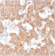 IHC staining of FFPE human adrenal gland with IL-2 antibody (clone IL2/3950). HIER: boil tissue sections in pH 9 10mM Tris with 1mM EDTA for 20 min and allow to cool before testing.