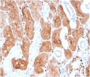 IHC staining of FFPE human adrenal gland tissue with IL-2 antibody (clone IL2/3950). HIER: boil tissue sections in pH 9 10mM Tris with 1mM EDTA for 20 min and allow to cool before testing.
