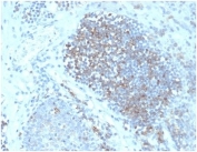 IHC staining of FFPE human lymph node with Fas Ligand (clone FASLG)antibody (clone FASLG/4456). HIER: boil tissue sections in pH 9 10mM Tris with 1mM EDTA for 20 min and allow to cool before testing.