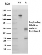 SDS-PAGE analysis of purified, BSA-free Surfactant protein D antibody (clone SFTPD/4363) as confirmation of integrity and purity.