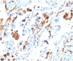 IHC staining of FFPE human lung tissue with Surfactant Protein D antibody (clone SFTPD/4363). HIER: boil tissue sections in pH 9 10mM Tris with 1mM EDTA for 20 min and allow to cool before testing.