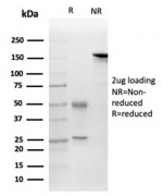 SDS-PAGE analysis of purified, BSA-free FGF-23 antibody (clone FGF23/4169) as confirmation of integrity and purity.