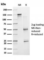 SDS-PAGE analysis of purified, BSA-free ZNF81 antibody (clone PCRP-ZNF81-2C7) as confirmation of integrity and purity.
