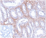 IHC staining of FFPE human kidney tissue with FGF-23 antibody (clone FGF23/4171) at 2ug/ml. Negative control inset: PBS instead of primary antibody to control for secondary binding. HIER: boil tissue sections in pH 9 10mM Tris with 1mM EDTA for 20 min and allow to cool before testing.