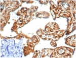 IHC staining of FFPE human placental tissue with recombinant Vinculin antibody (clone VCL/7091R) at 2ug/ml. Negative control inset: PBS instead of primary antibody to control for secondary binding. HIER: boil tissue sections in pH 9 10mM Tris with 1mM EDTA for 20 min and allow to cool before testing.