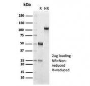 SDS-PAGE analysis of purified, BSA-free recombinant IL15 antibody (clone IL15/7048R) as confirmation of integrity and purity.
