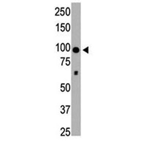 HDAC4 antibody used in western blot to detect HDAC4 in mouse brain tissue lysate. Expected molecular weight: ~140 kDa (full length), ~95 kDa (truncated).