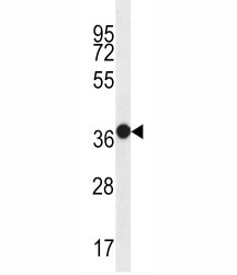 MUC15 antibody western blot analysis in WiDr lysate.