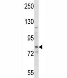 SMO antibody western blot analysis in HepG2 lysate. Predicted molecular weight: ~86kDa.