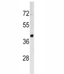 Western blot analysis of TROP2 antibody and HL-60 lysate. Predicted molecular weight ~36 kDa.