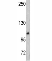 Western blot analysis of OGT antibody and mouse bladder tissue lysate. Expected/observed molecular weight: 110-117 kDa.