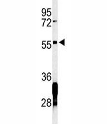Western blot analysis of RNF8 antibody and Jurkat lysate. Predicted molecular weight ~56 kDa but may be observed at larger sizes due to ubiquitination.