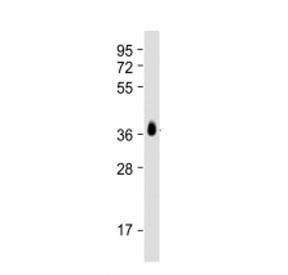 Western blot testing of BRCA2 at 1:2000 + partial recombinant protein. Predicted molecular weight of full protien: ~384 kDa.