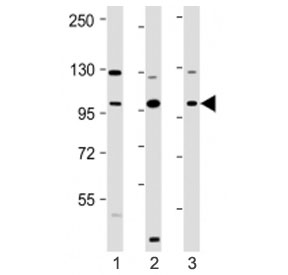 Western blot testing of VAV2 antibody at 1:2000: Lane 1) human HeLa, 2) MCF7 and 3) SH-SY5Y cell lysate. Predicted molecular weight ~100 kDa.