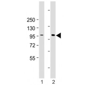 Western blot testing of HACE1 antibody at 1:2000: Lane 1) human HEK293 and 2) 293T/17 cell lysate. Predicted molecular weight ~102 kDa.
