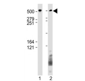 Western blot testing of BIRC6 antibody at 1:1000: Lane 1) huamn SH-SY5Y and 2) HeLa cell lysate. Predicted molecular weight ~530 kDa.