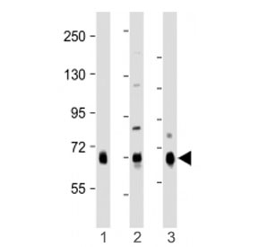 Western blot testing of DLL4 antibody at 1:1000: Lane 1) human lung, 2) mouse kidney and 3) rat lung lysate. Predicted molecular weight ~75 kDa.