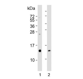 Western blot testing of human 1) kidney and 2) pancreas lysate with REG3G antibody. Expected molecular weight: 15-19 kDa.