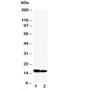 Western blot testing of IFITM1 antibody and Lane 1:  SW620;  2: CEM cell lysate