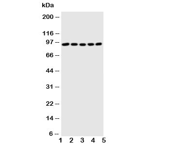 Western blot testing of STAT1 antibody and Lane 1:  MM451;  2: HeLa;  3: HT1080;  4: SW620;  5: Jurkat cell lysate. Predicted molecular weight: ~91/84 kDa (alpha/beta).