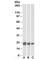 Western blot testing of human [A], mouse [B] and rat [C] heart lysate with CSRP3 antibody at 0.01ug/ml. Predicted molecular weight: ~21 kDa.