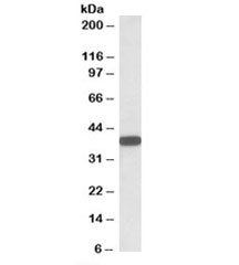 Western blot testing of human umbilical cord lysate with CYB5R3 antibody at 0.01ug/ml. Predicted molecular weight (human): ~34/32/38kDa (isoforms 1/2/3).