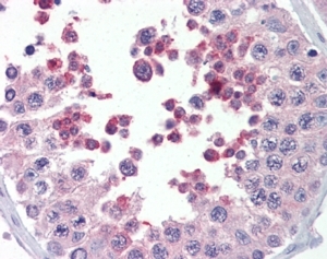 IHC testing of FFPE human testis with MLL4 antibody at 5ug/ml. HIER: steamed with pH6 citrate buffer, AP-staining.
