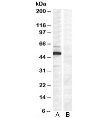 Western blot testing of COS7 cell lysate transfected with full length human DCDC2 [A] and untransfected control COS7 cells [B] with DCDC2 antibody at 0.2ug/ml. Predicted molecular weight: ~53/26kDa (isoforms 1/2).