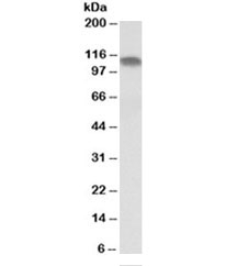 Western blot testing of human skeletal muscle lysate with PGC1A antibody at 0.1ug/ml. Predicted molecular weight ~91 kDa.